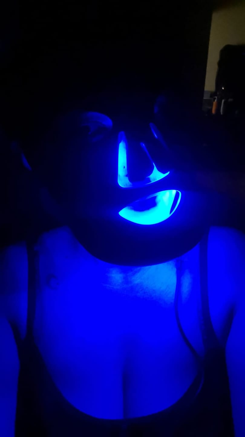 Customer photo review of Lumara Máscara LED