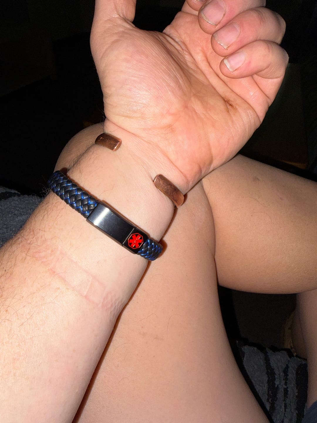 Customer photo review of MedCore Braided Leather Medical ID Bracelet
