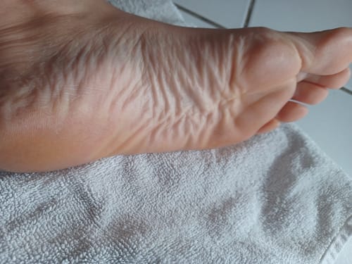Customer photo review of LOVASKIN Discovery Kit SPECIAL TV OFFER - Twice the treatments