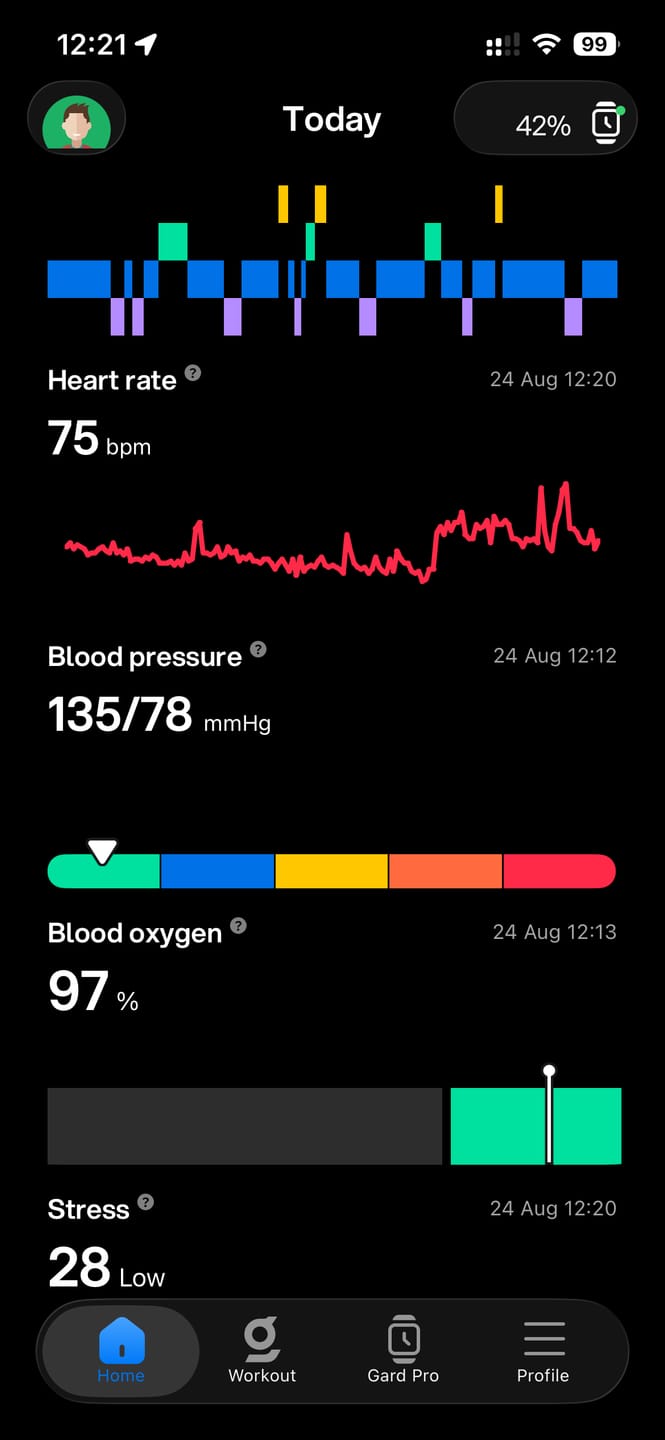Customer photo review of Gard Pro Health 4 Smartwatch