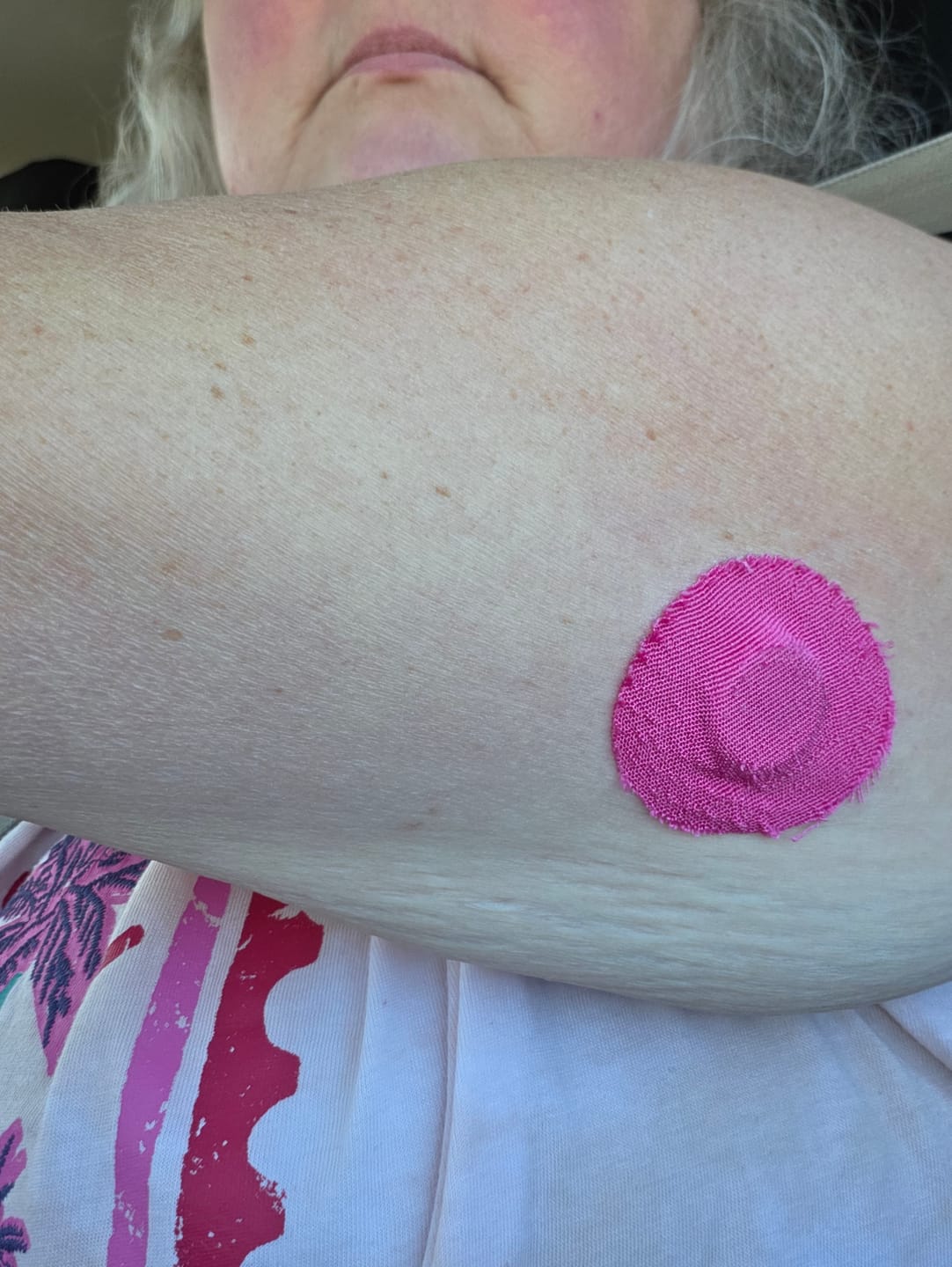Customer photo review of Skin Grip Original - Libre 3+ Adhesive Patches