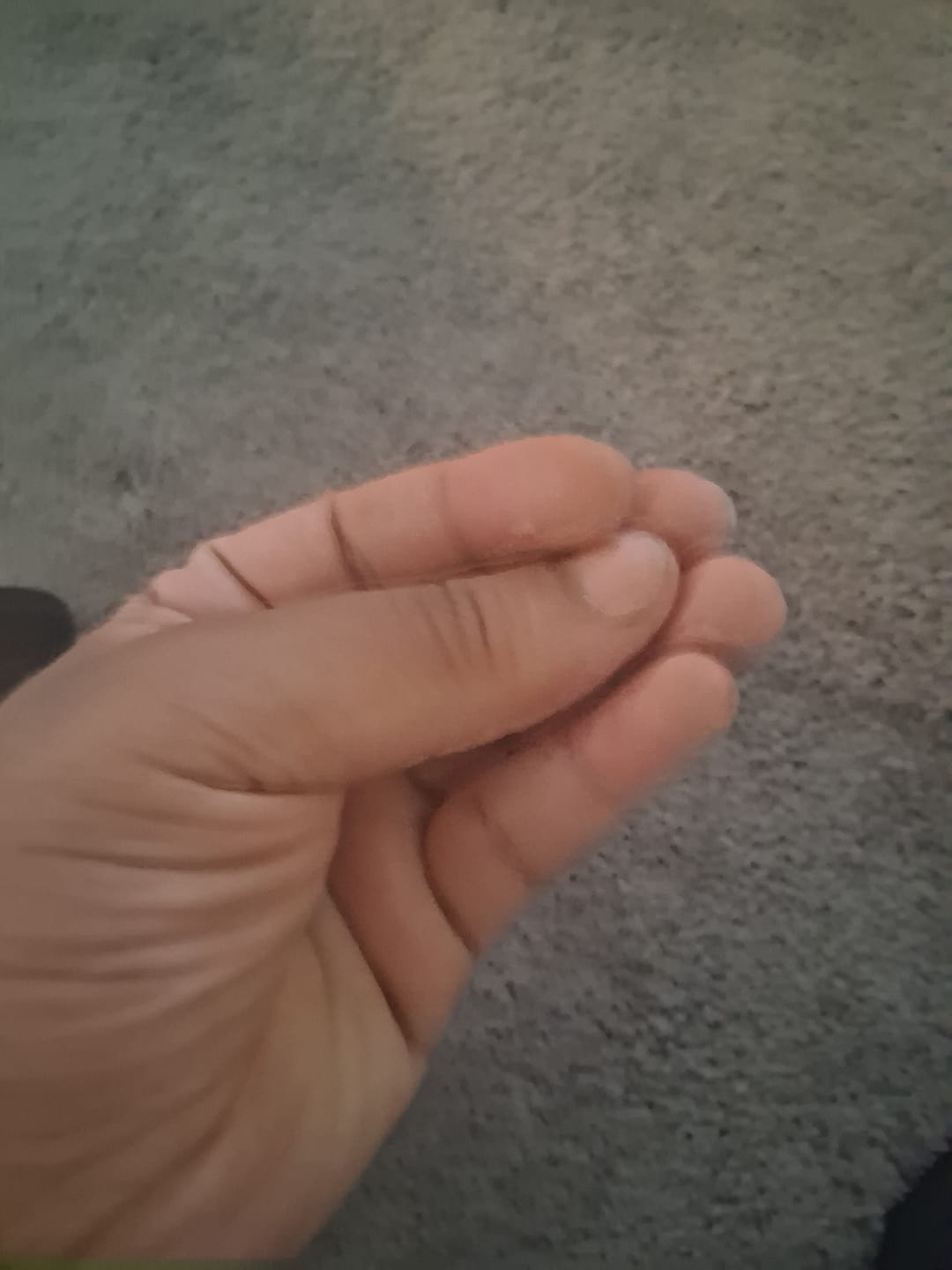 Customer photo review of Xhale Starter Pack