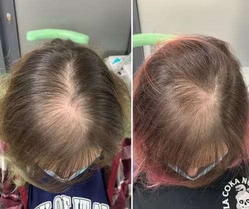Customer photo review of Savon Capillaire Anti-Chute & Densité