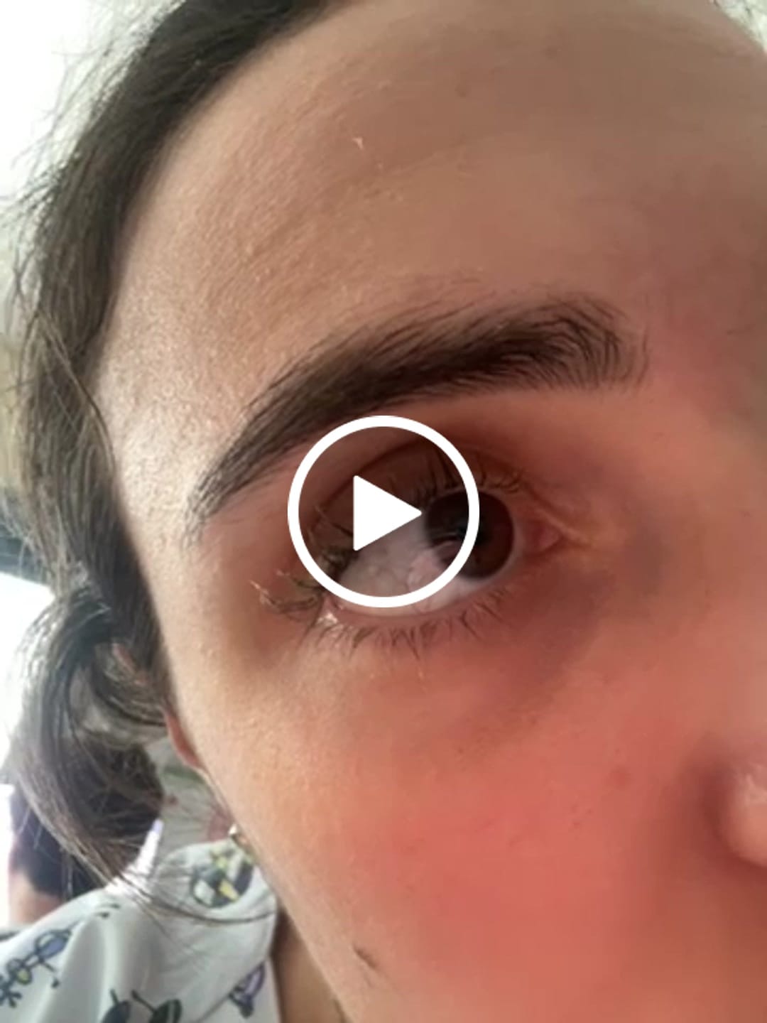 Customer video review of Pegamento "Fixing Gel Inlei®" 5ml