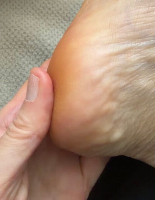 Customer photo review of SilkeFod - Fra ru hæle til silkebløde fødder