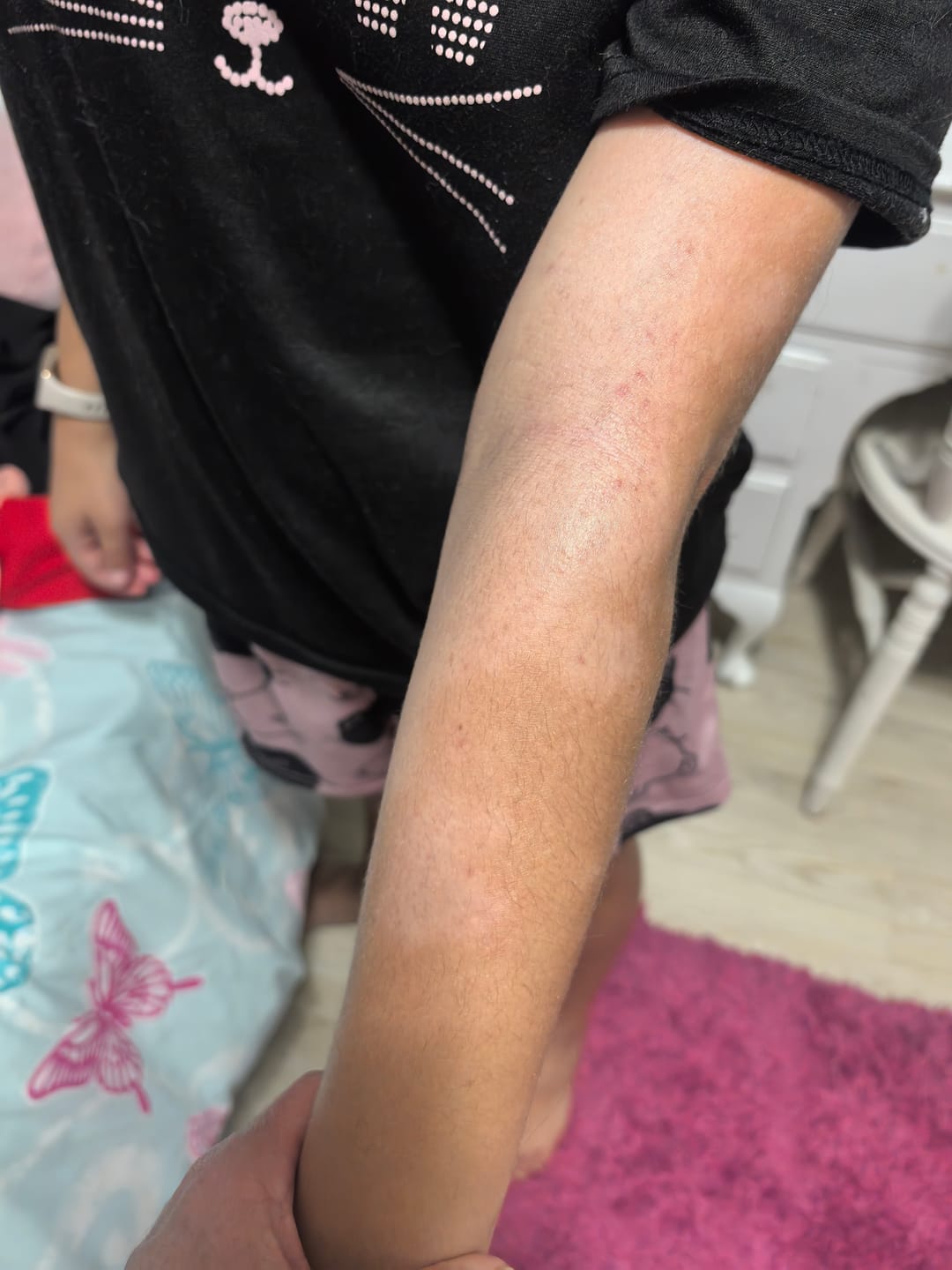 Customer photo review of Relief Balm
