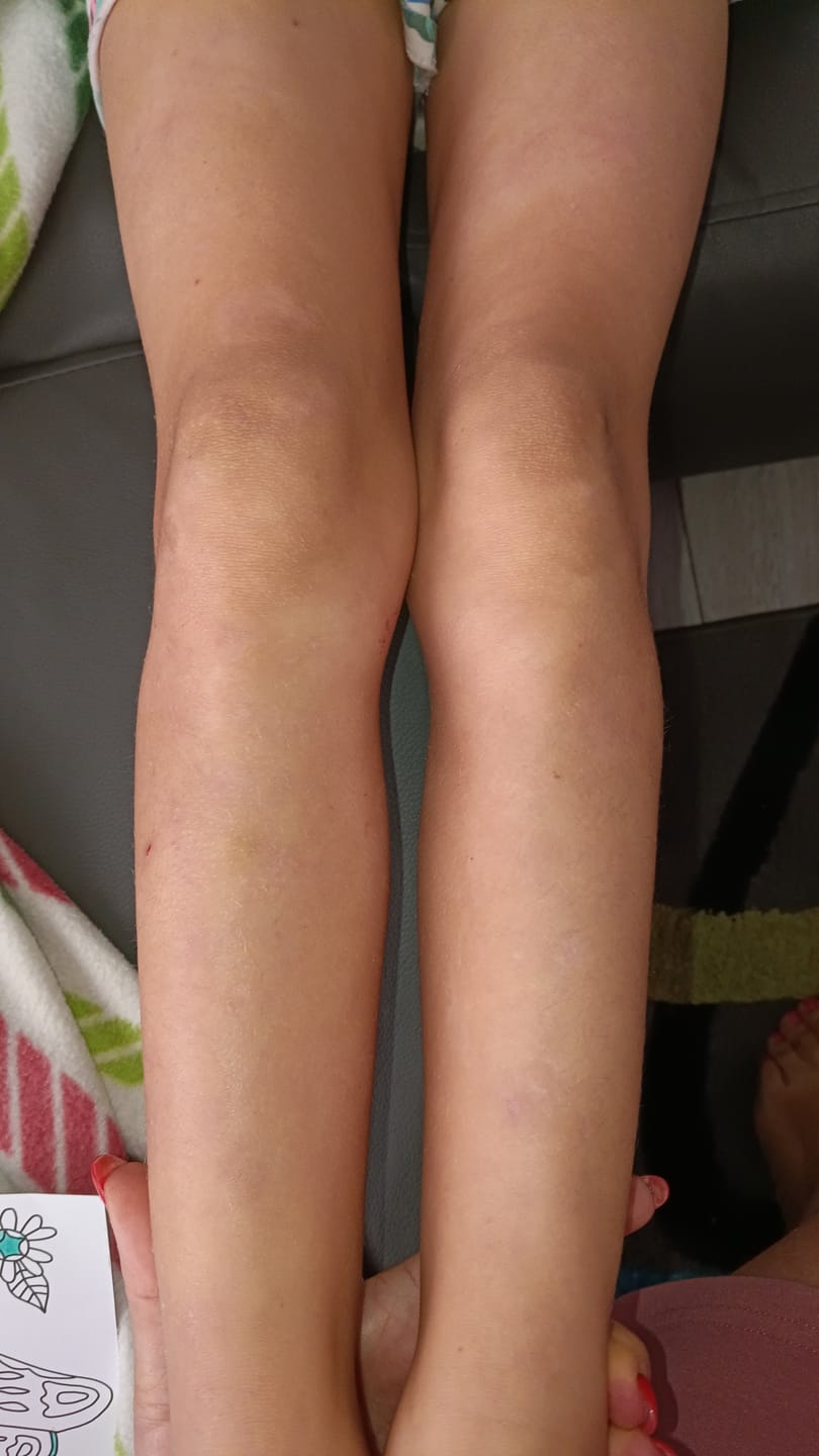Customer photo review of Whipped Grass-Fed Tallow Body Cream | With Jojoba Oil