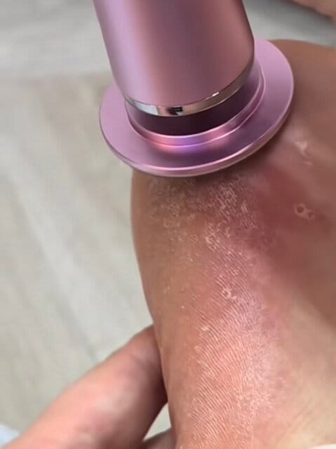 Customer photo review of SilkeFod - Fra ru hæle til silkebløde fødder