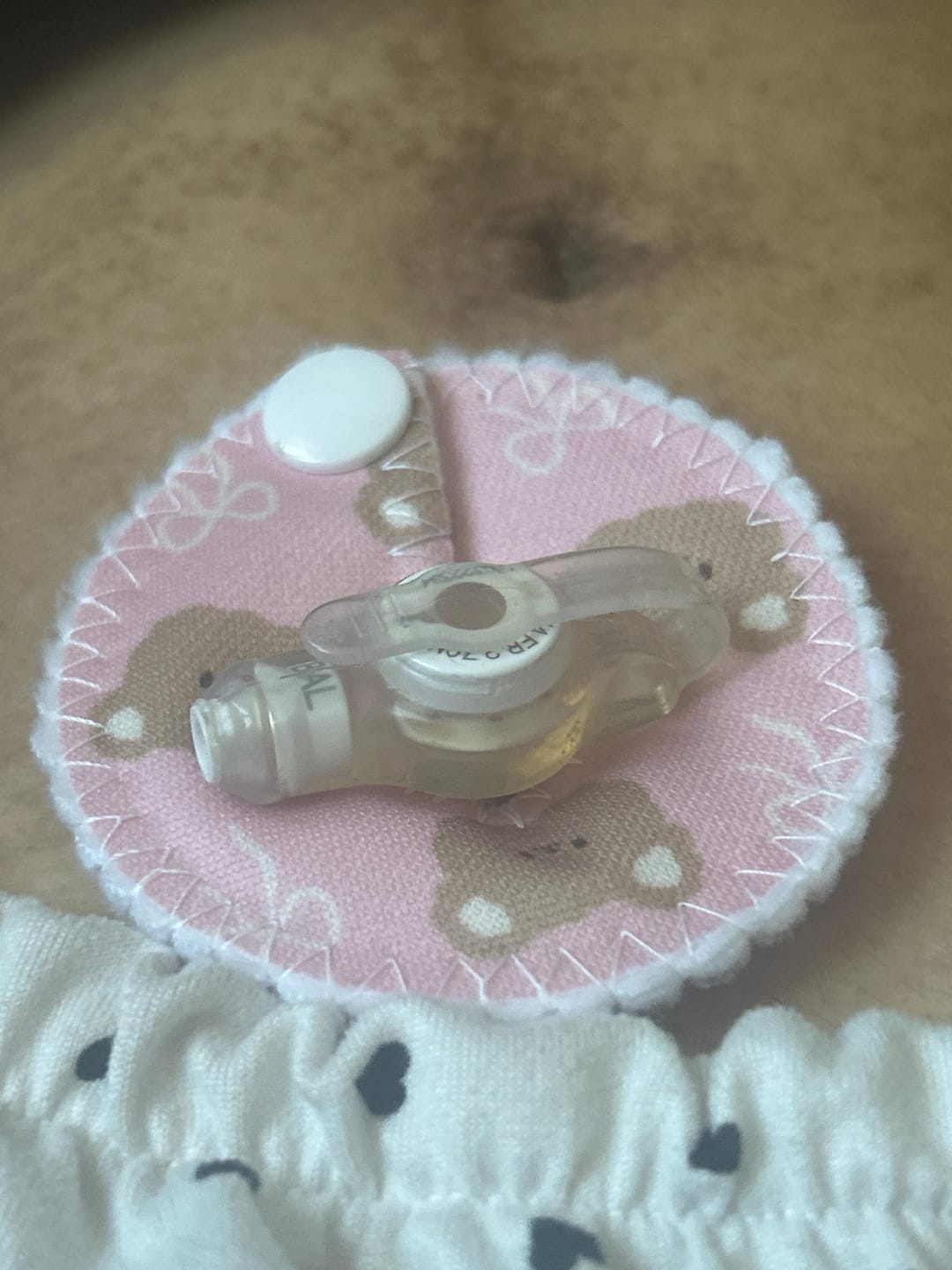 Customer photo review of Bows and bears Feeding tube pads | AMT button pads | Mic-key button pads | GTube Pads