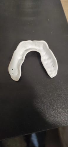 Customer photo review of Lunate Overnight Protection Mouth Guard