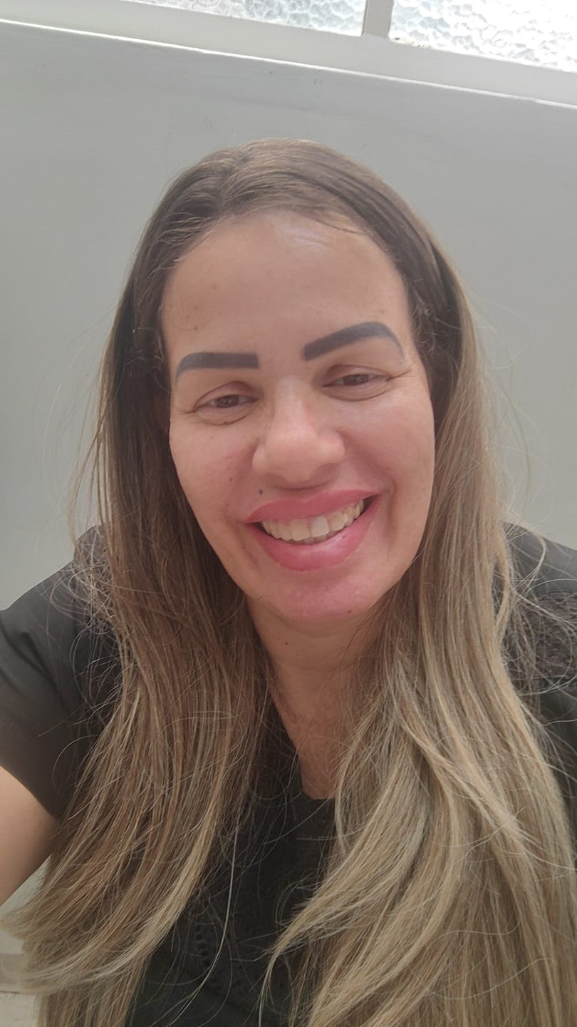 Customer photo review of Lace Front HD Beyonce Ombre Loira 613 - Repartição Livre 13x4