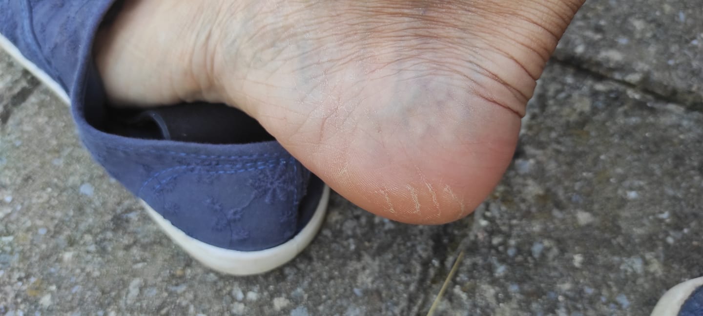 Customer photo review of ✨ HoneyGlow™ – Kit Beauté Pieds