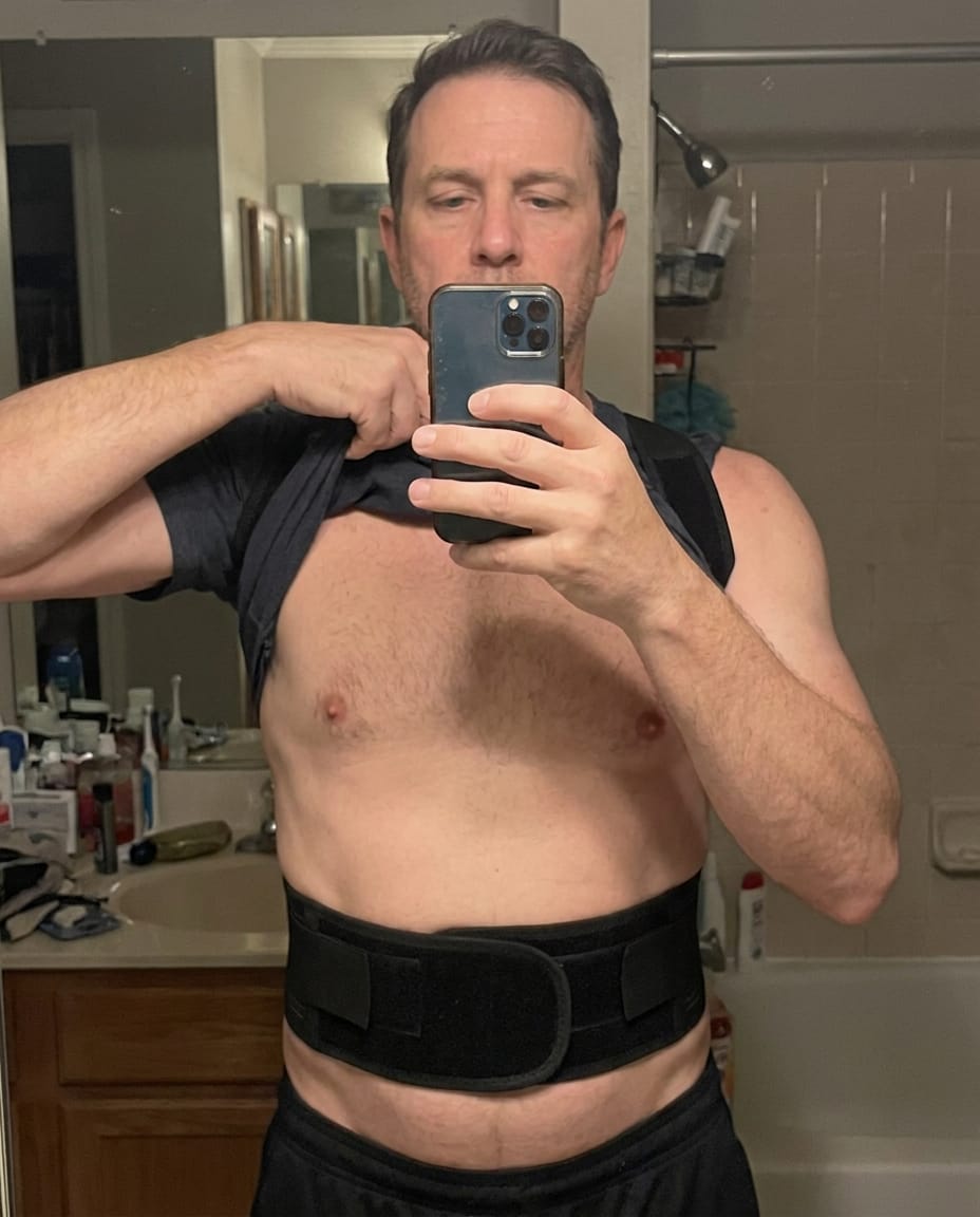 Customer photo review of FROSTIQ TourBrace™