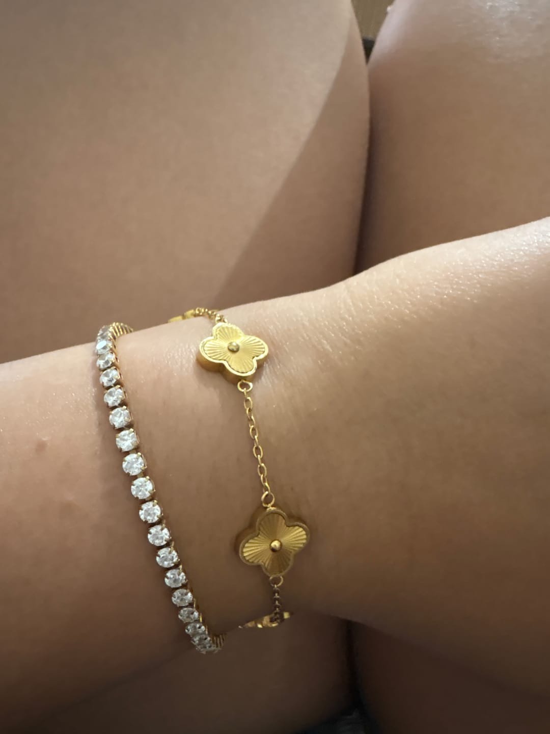 Customer photo review of Plain Clover Armband