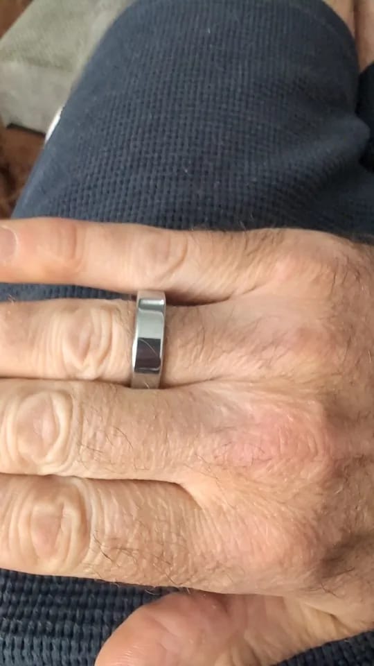 Customer photo review of Aura Ring