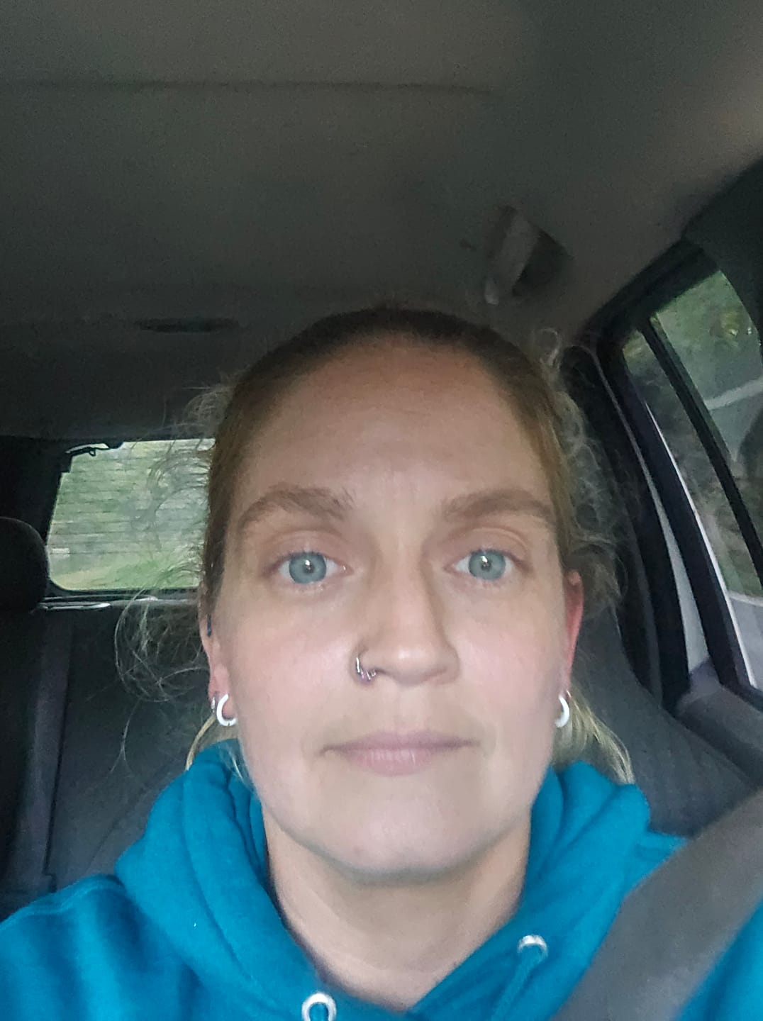 Customer photo review of Himalaya Blue Prescription Colored Contact Lenses