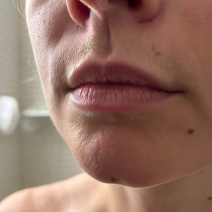 Customer photo review of Velura™ Feminine Revival Capsules