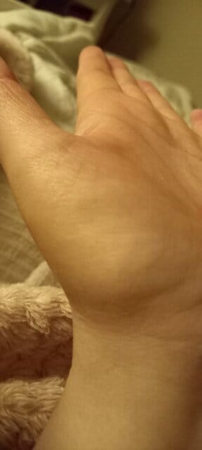 Customer photo review of Repair Balm For Eczema & Psoriasis