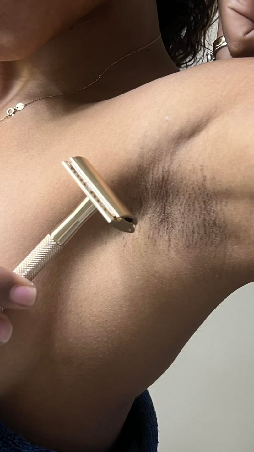 Customer photo review of SKINRAZR™ — Rasuradora de precisión para una piel suave