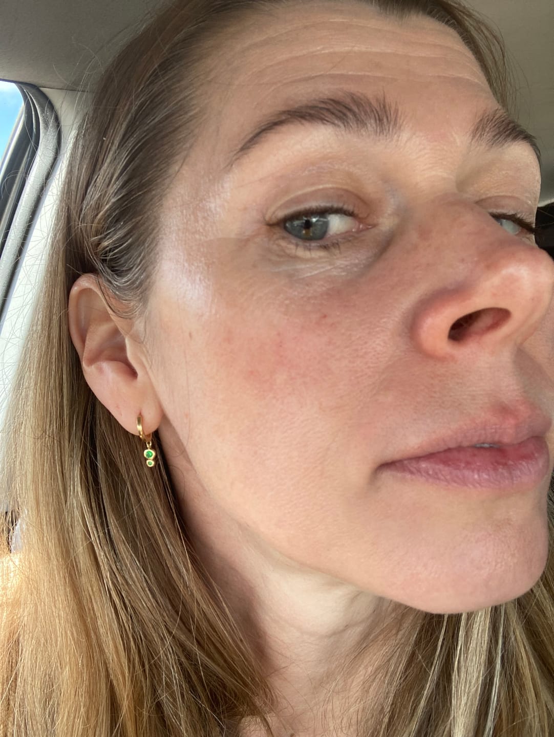 Customer photo review of Natural Sunscreen SPF 50