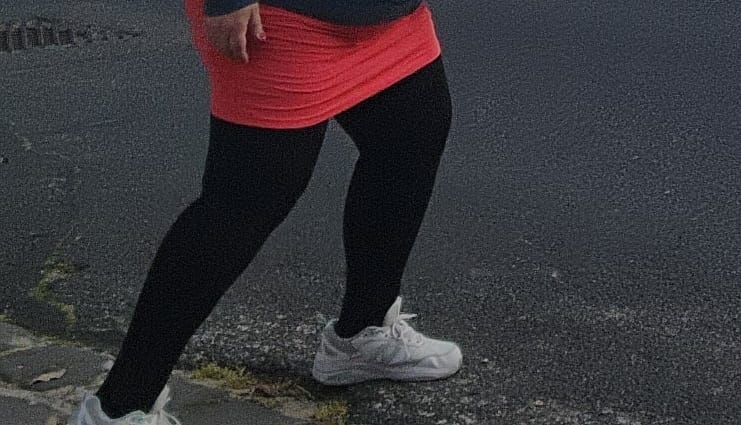 Customer photo review of NuSoothe® Open-Toe High Waisted Compression Tights