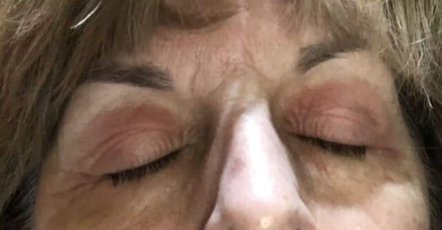 Customer photo review of Repair Balm For Eczema & Psoriasis
