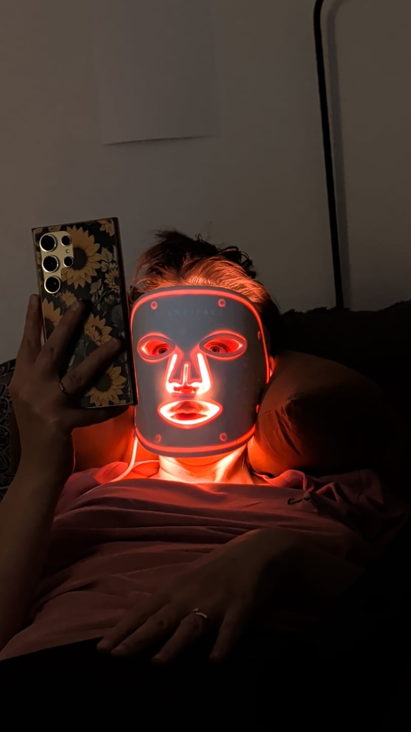 Customer photo review of Skinboosting LED mask
