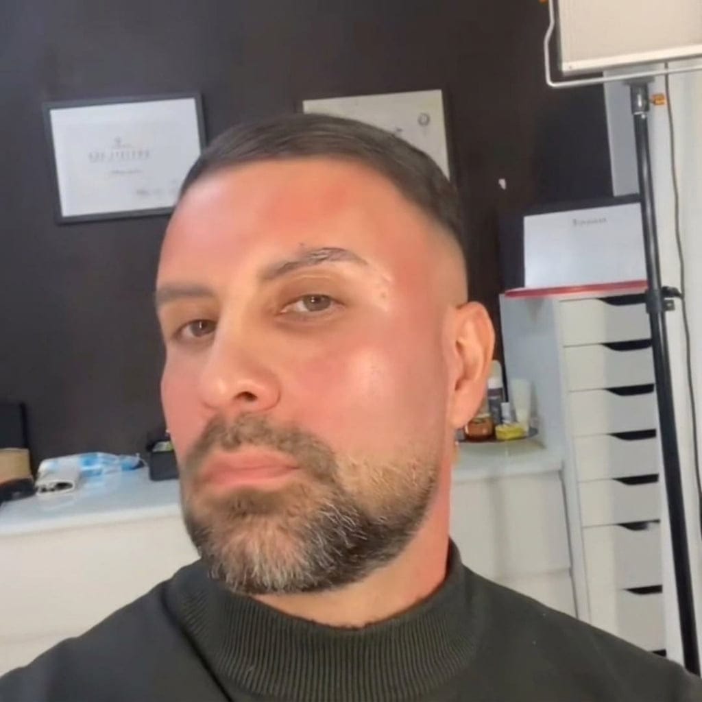 Customer photo review of BLU. GHK-Cu Peptides Serum