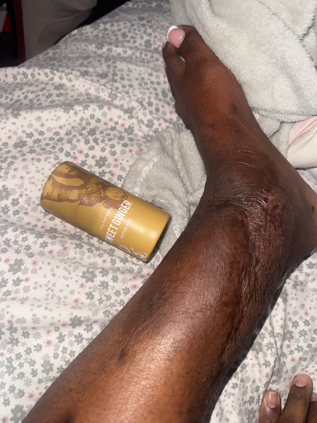 Customer photo review of [Nut-Free] Sweet Ginger Dry Oil for Sensitive Skin