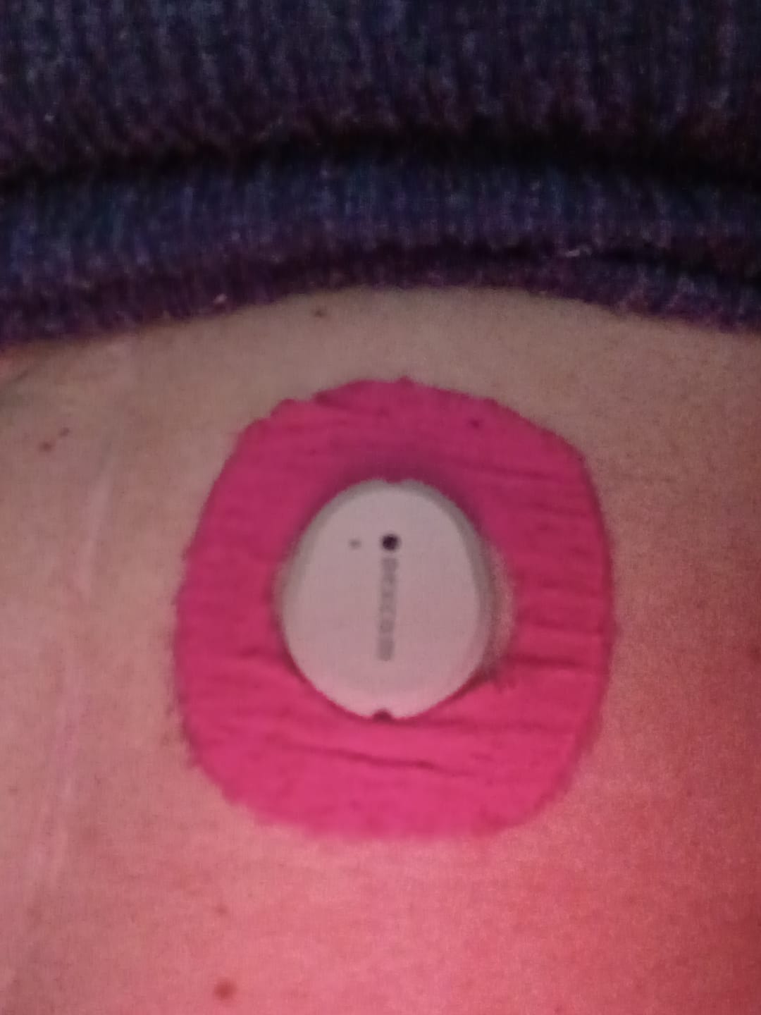 Customer photo review of Skin Grip Original - Dexcom G7 & Stelo Adhesive Patches (With Cutout)
