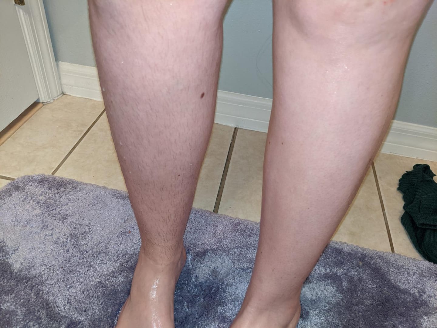 Customer photo review of SKINRAZR™ — Rasuradora de precisión para una piel suave