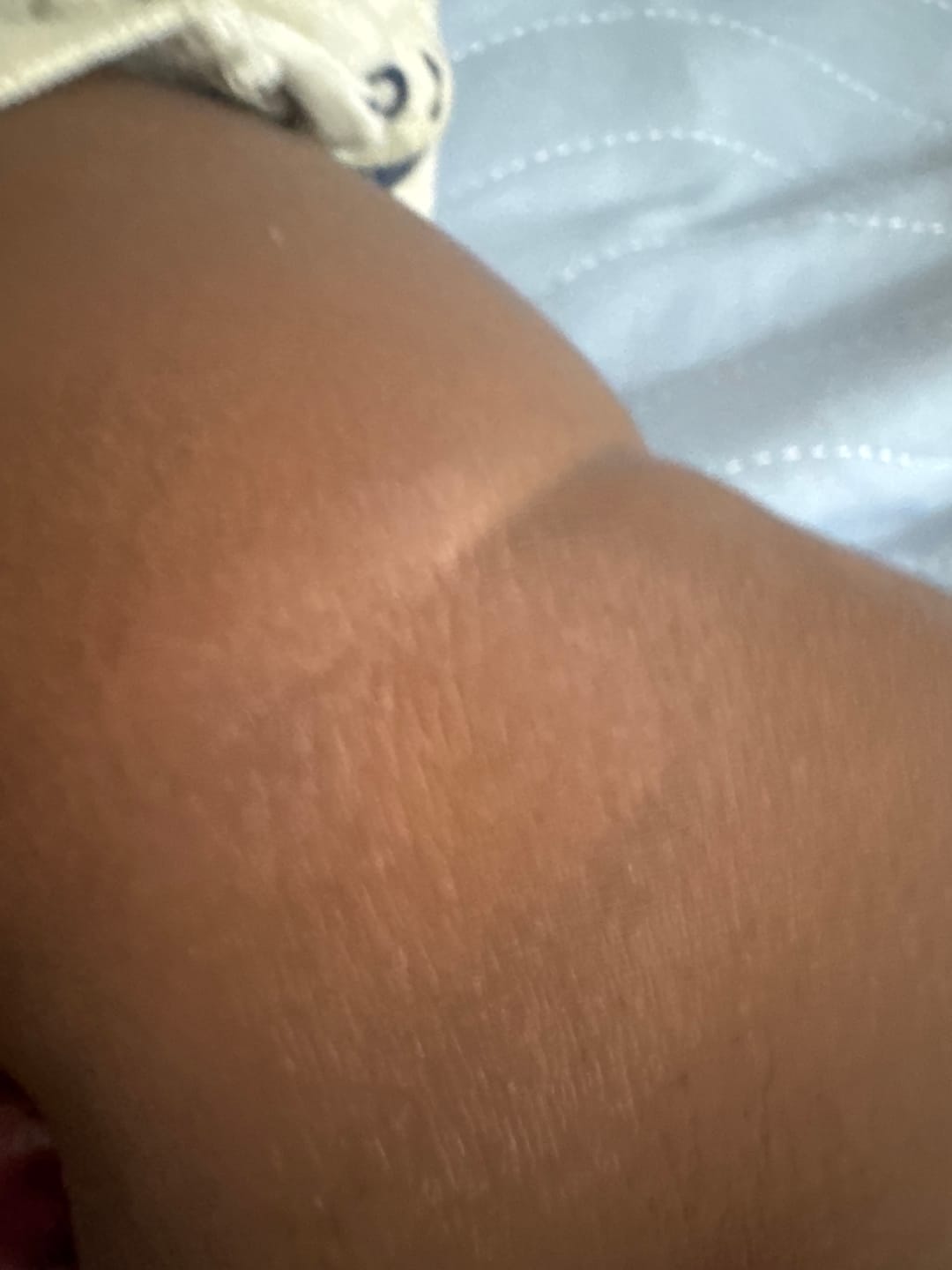 Customer photo review of Calm Skin-Relief Kit