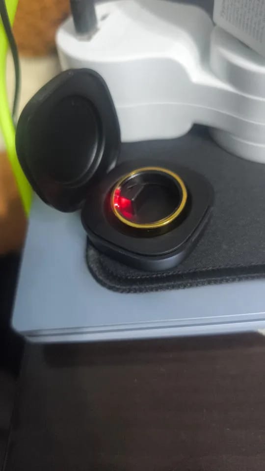 Customer photo review of Aura Ring