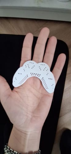 Customer photo review of Lunate Overnight Protection Mouth Guard