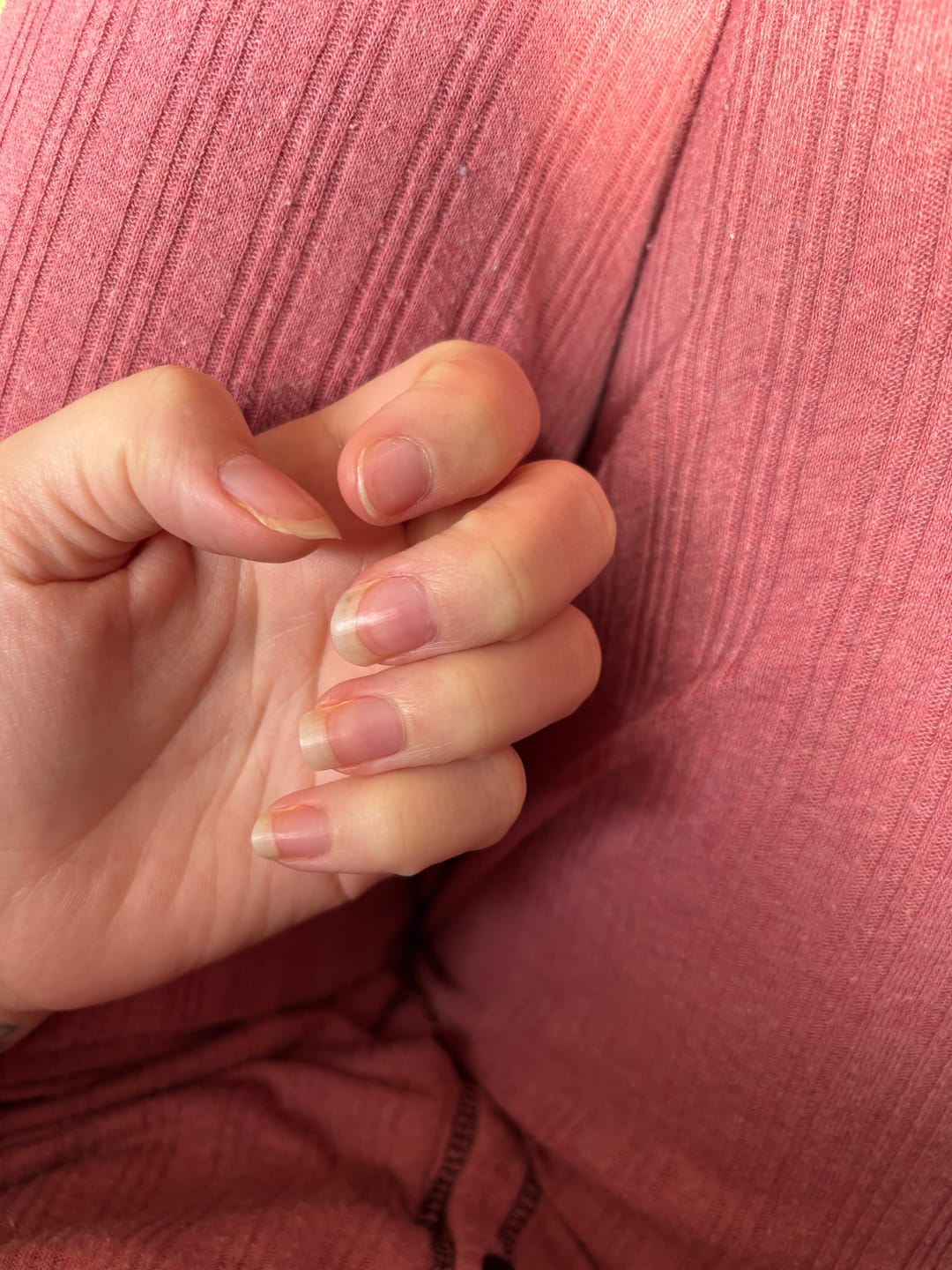 Customer photo review of Aurely-Care™ UV-Nageltherapiegerät