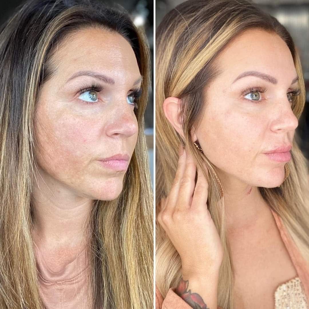 Customer photo review of Rétinal Shot