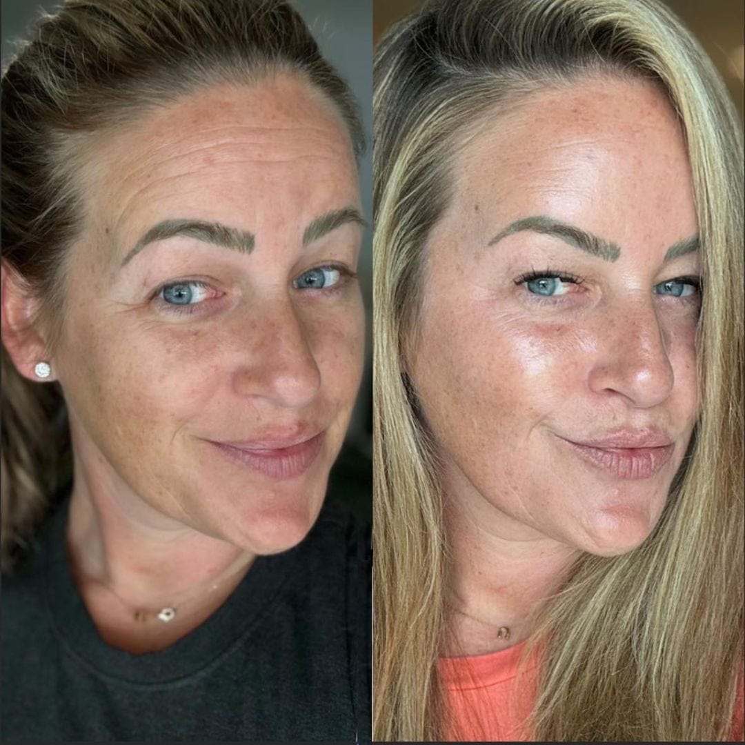 Customer photo review of Rétinal Shot
