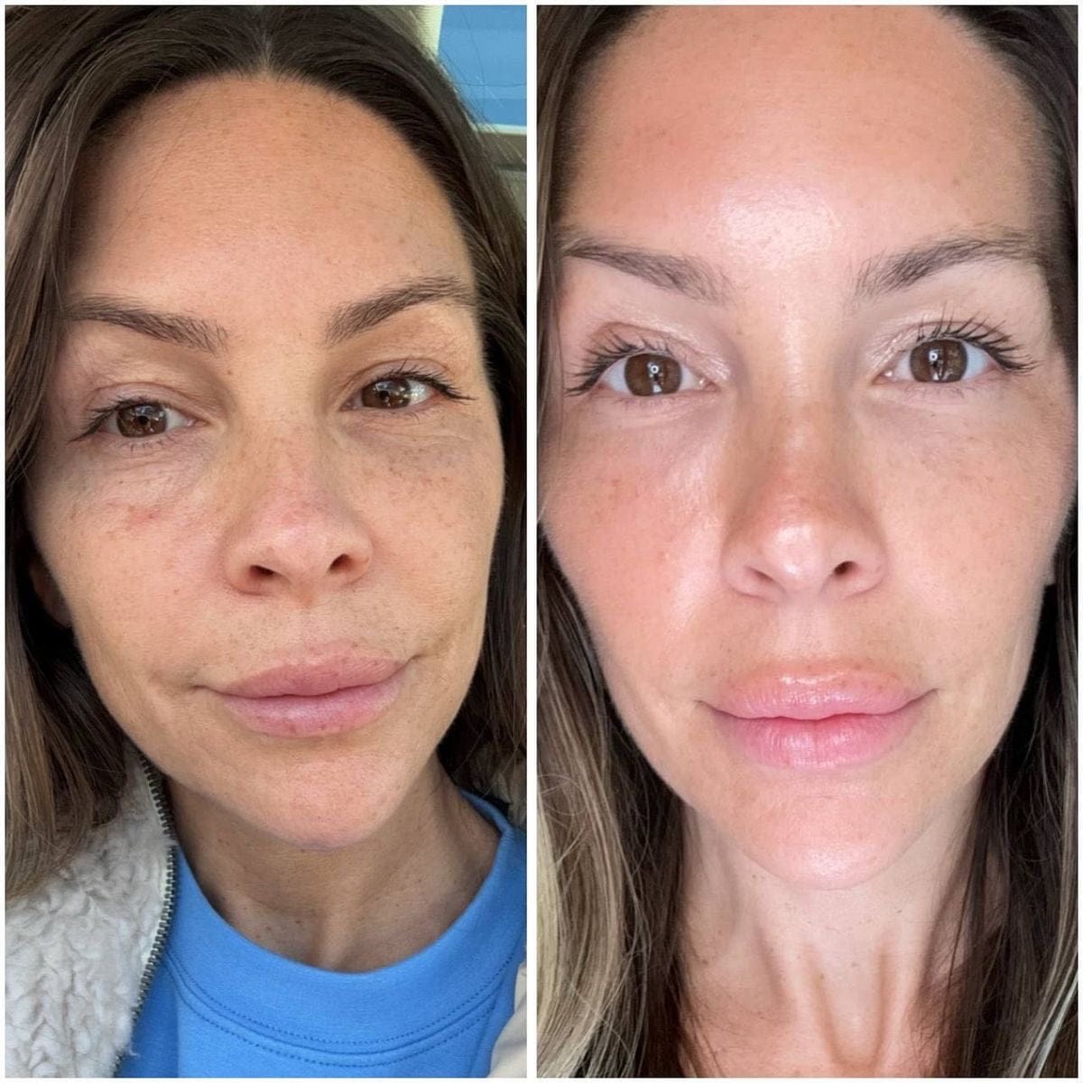 Customer photo review of Rétinal Shot