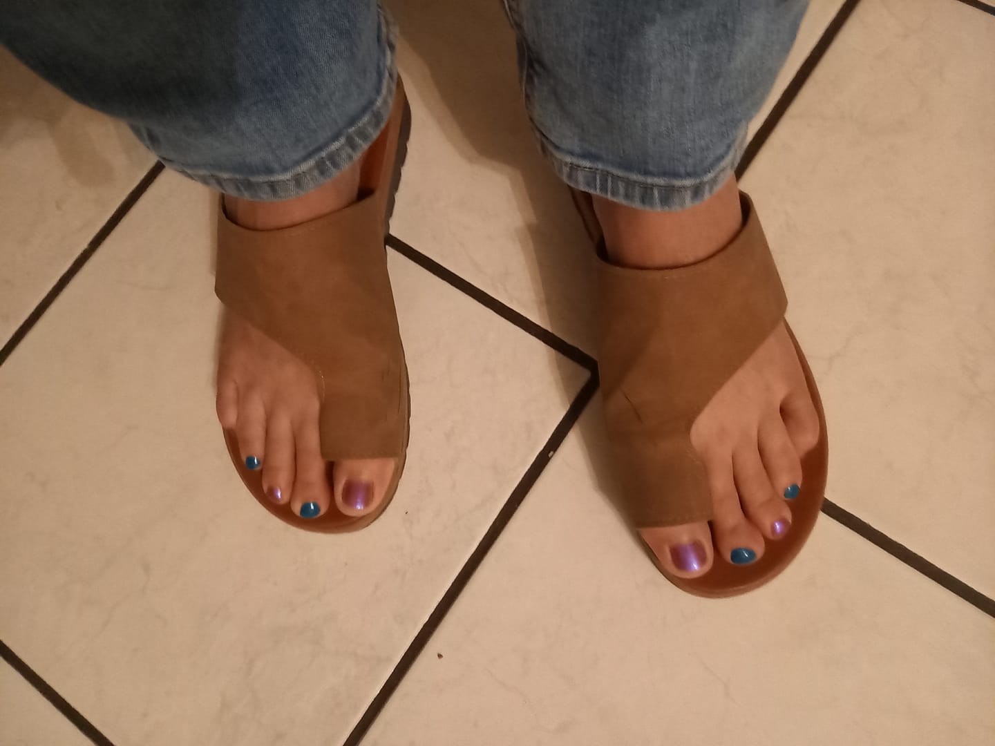 Customer photo review of Sandales Orthopédiques correctrices des Oignons - Hallux Valgus - Gros Orteil