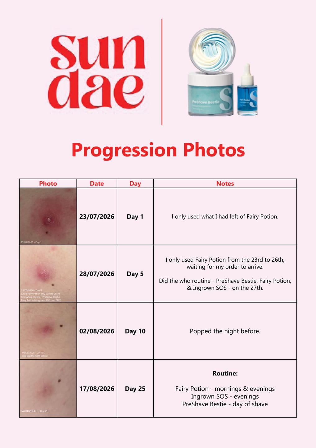 Customer photo review of Ingrown SOS