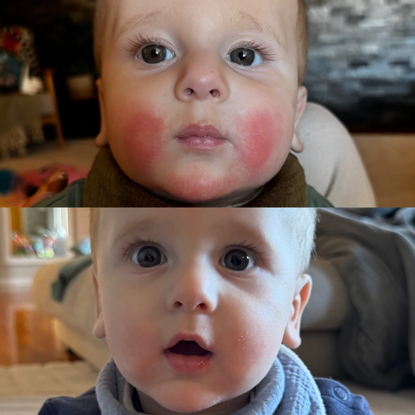 Customer photo review of Organic Skin Barrier Balm