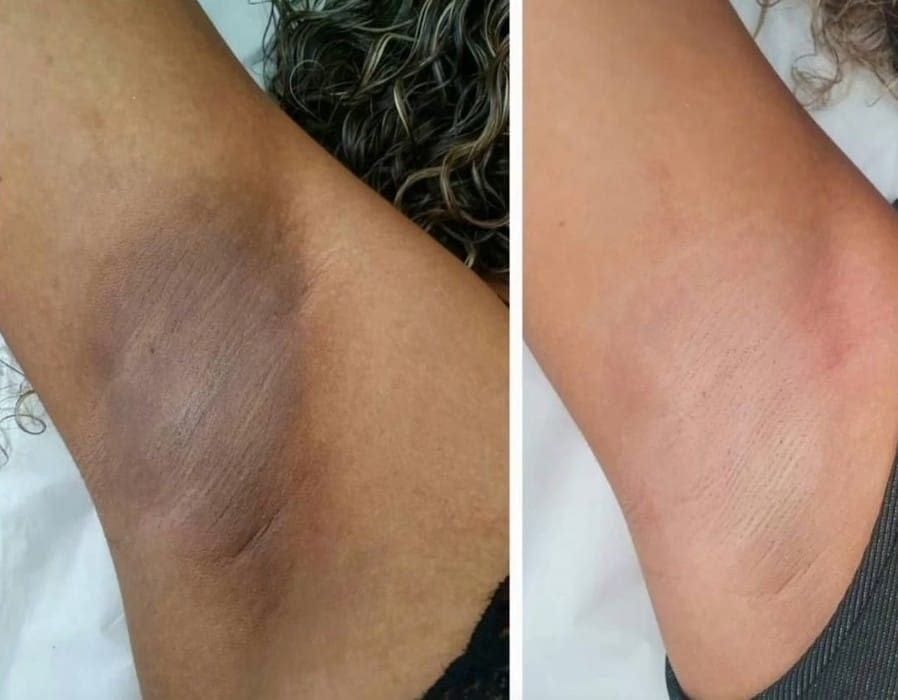 Customer photo review of Rétinal Shot