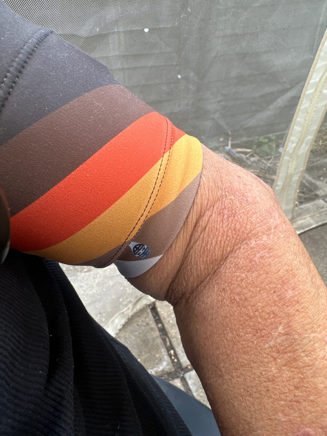 Customer photo review of Glucose Monitor and Insulin Pump Armband - Dia-Band Summer Edition
