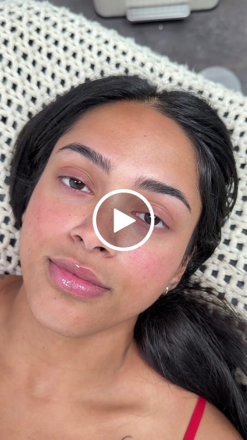Customer video review of BKO Lift System - Perm Solution