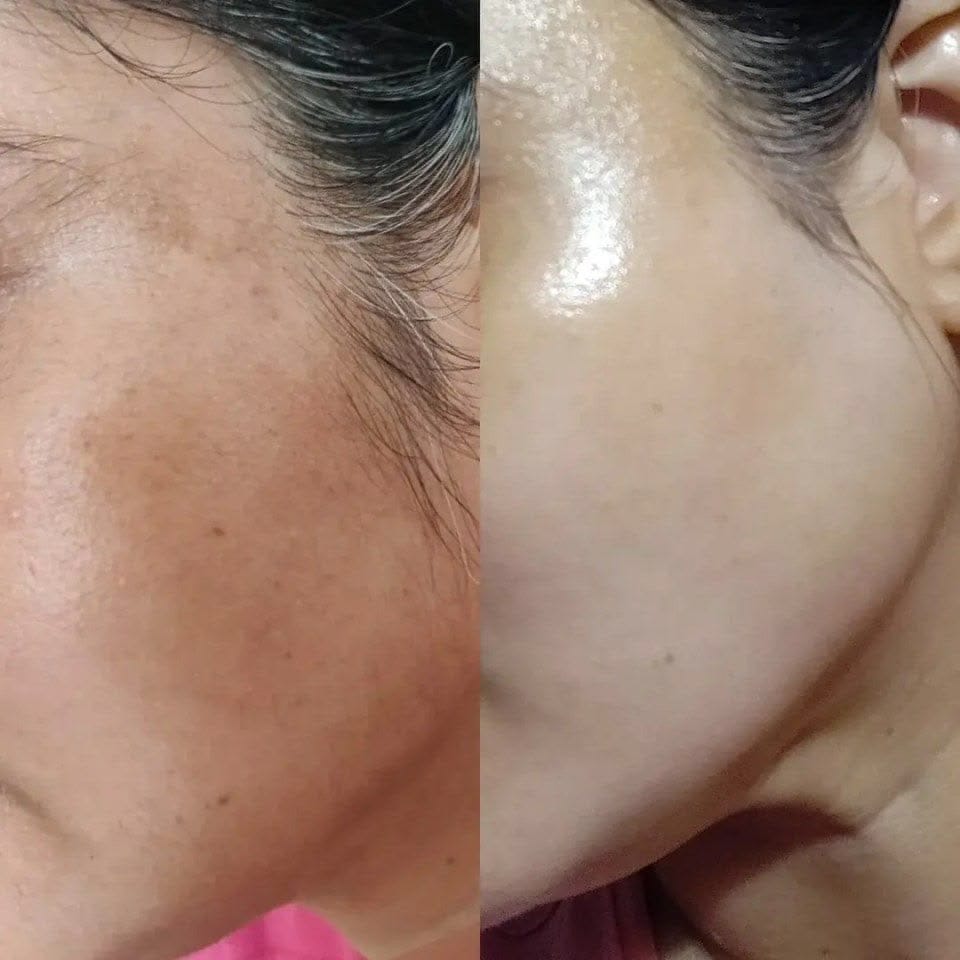 Customer photo review of Rétinal Shot
