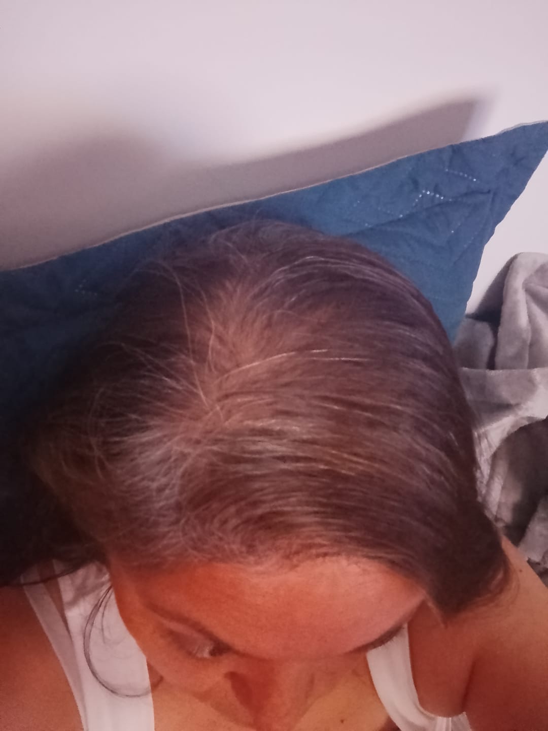 Customer photo review of Minoxidil 1 mg con 90 tabletas para 3 meses de tratamiento
