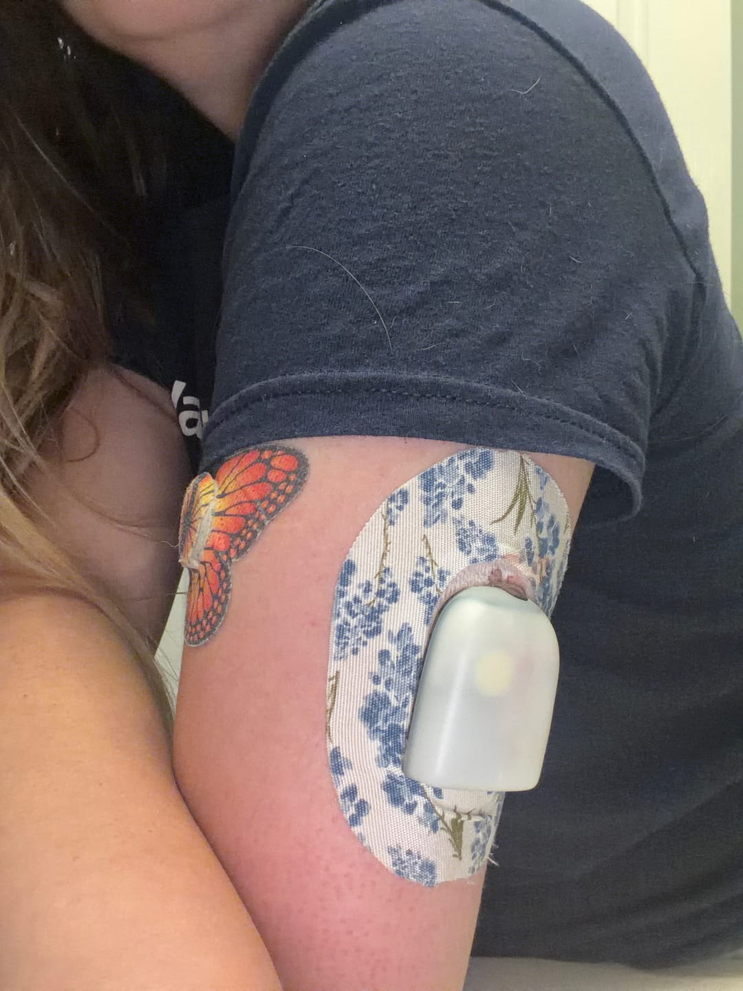 Customer photo review of Skin Grip Original - Omnipod Adhesive Patches