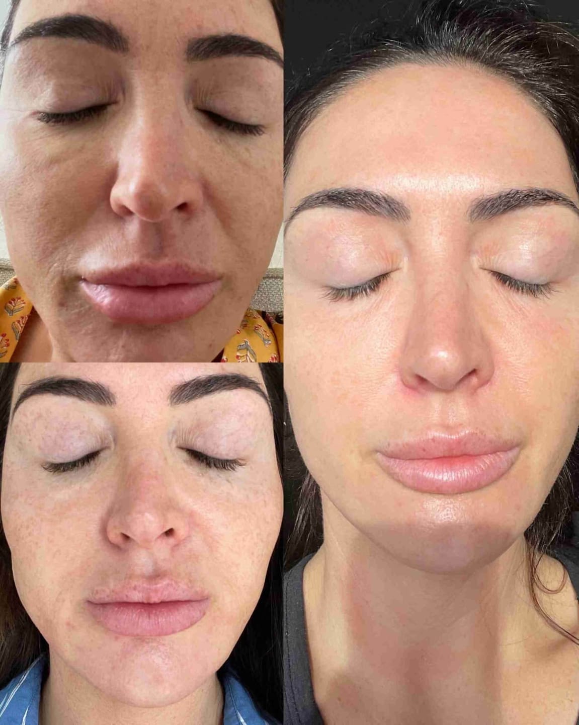 Customer photo review of Rétinal Shot