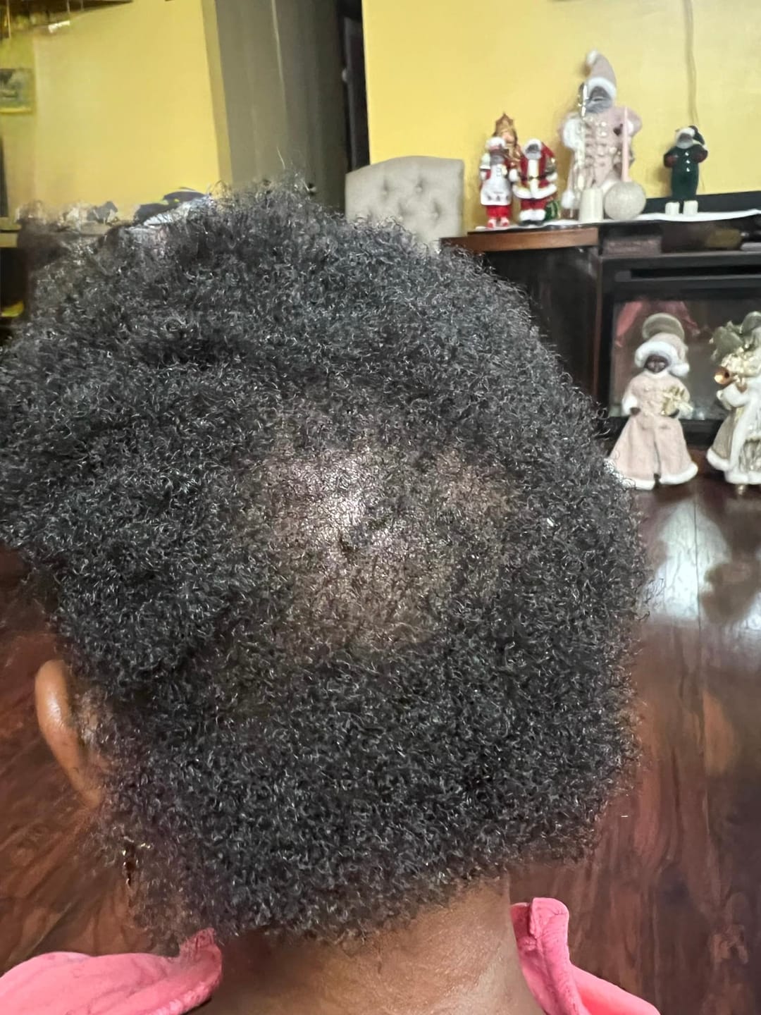 Customer photo review of Scalp Therapy System