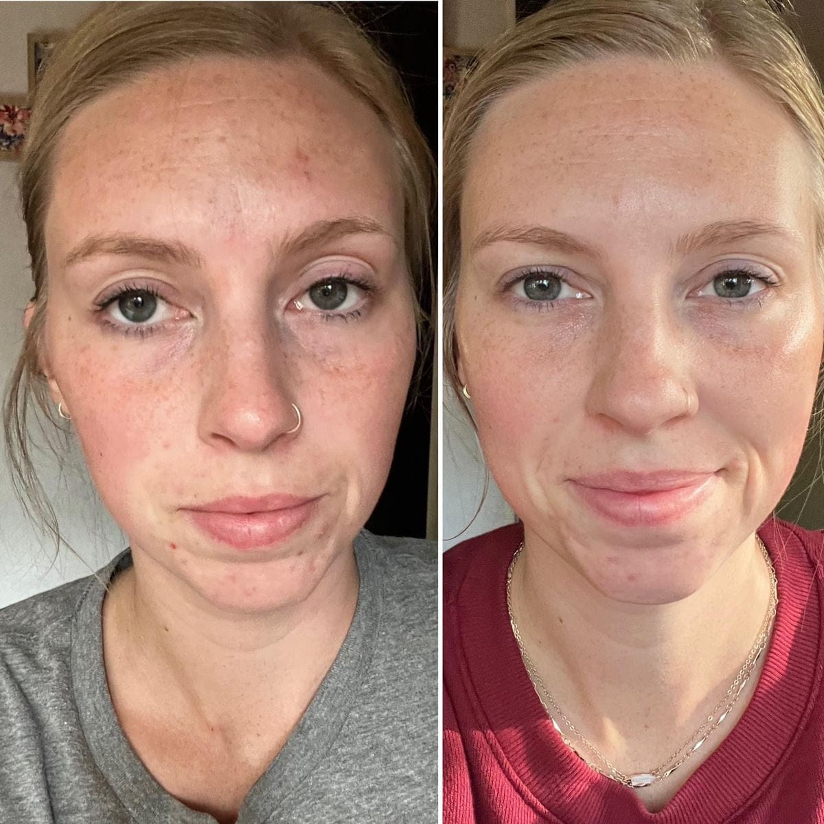 Customer photo review of Rétinal Shot